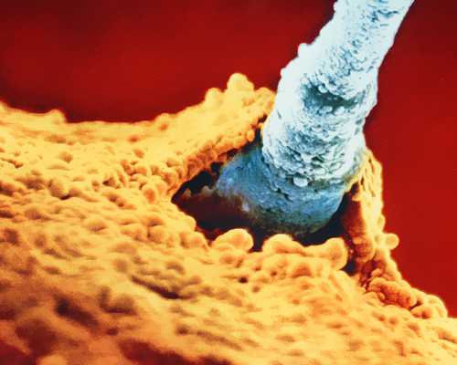 成都专业代生小孩,试管婴儿在产前什么时候能分岀男女？_剖腹产再孕四个月破