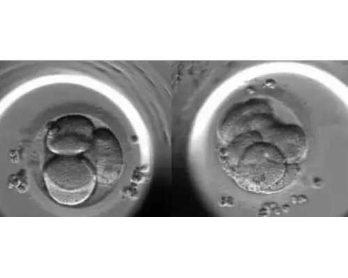 成都代孕代孕可以补钙吗,四川成都试管婴儿,成都试管婴儿医院