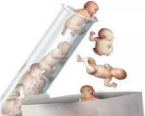 成都试管代孕龙凤胎概率,成都做试管私立医院_成都试管医院排名，成都做试管