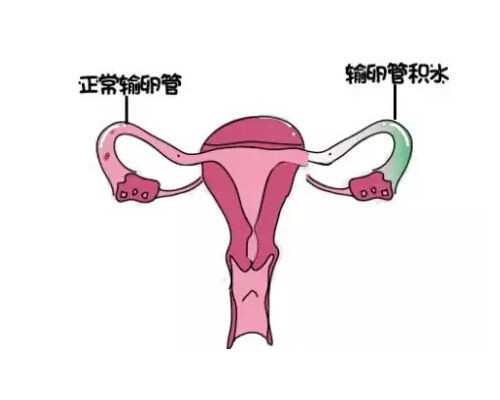 成都最好的代怀,二胎想生女儿，问一问成都哪里做试管可以选择性别？-试管移