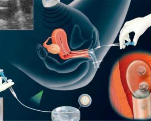 成都供卵在哪里,成都试管婴儿6家医院费用对比 全流程价格不贵