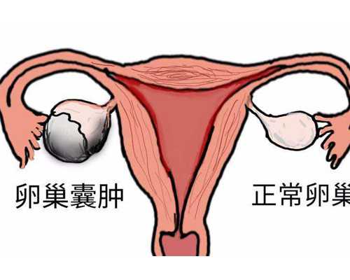 成都供卵哪个医院,成都做第三代试管婴儿费用大概是多少？