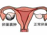 成都供卵哪个医院,成都做第三代试管婴儿费用大概是多少？
