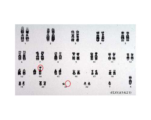 成都助孕招聘,成都大学第二附属医院简介,2023成都借卵试管医院排名公开附河南
