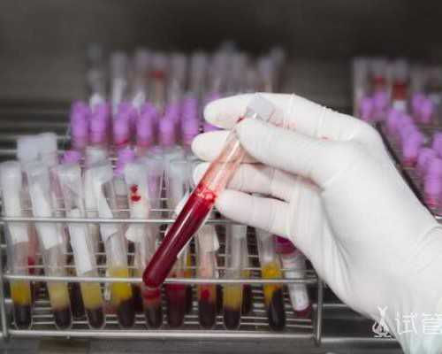 成都供卵子,北京三代成都试管成功率医院排名_南京供卵试管婴儿费用多少-子宫