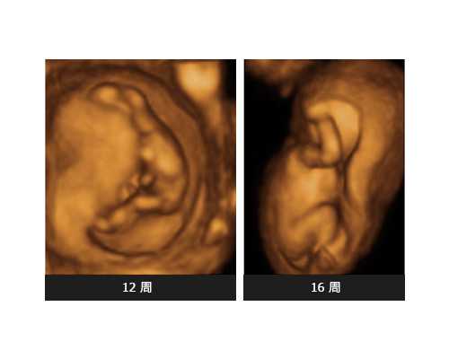 孕期能查出孩子先天性心脏病吗