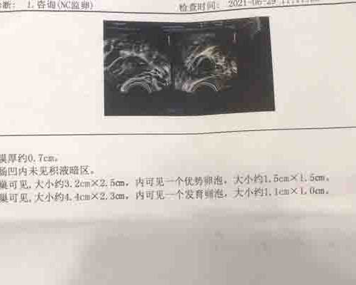 成都代生孩子套餐,供卵群成都，供卵病友群