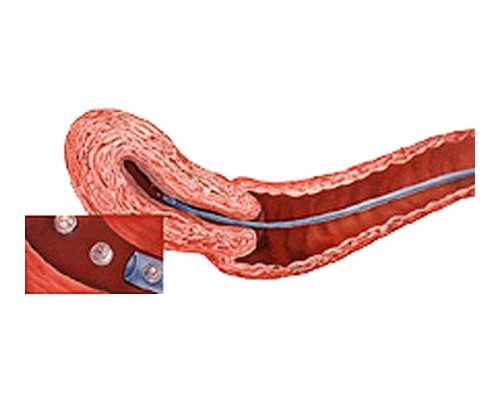 成都试管代怀经历分享,成都地下供卵试管（成都哪里可以供卵）