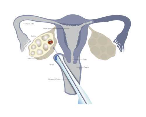 成都最好的代孕产子公司,成都第七人民医院和省医院_，成都试管机构2023
成都