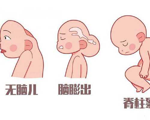 成都代怀孕哪里找,成都做三代试管婴儿多少钱？2023
年试管费用