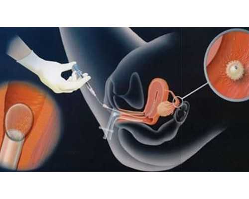 成都2023最新代孕价格表,成都做试管私立医院_成都试管医院排名，成都做试管的