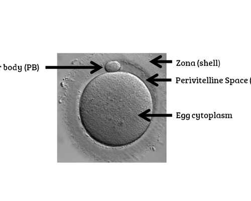 二胎会难产吗（难产假）