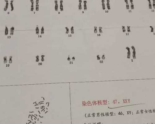 成都专业代孕中心,吸烟对做泰国试管婴儿有影响吗？_深圳借卵试管婴儿医院