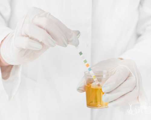 成都喜孕代孕网,各位JMS，请问试管要请假几天？_人工周期是否需要查种植窗