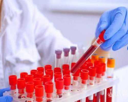 成都助孕技术协会官网,成都哪个医院做试管成功率高点啊,一医院采样点通道多