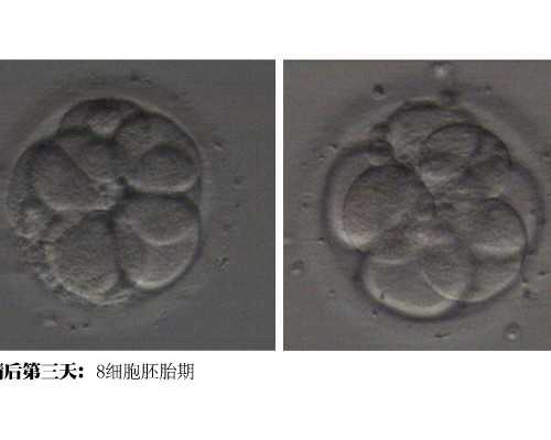 试管婴儿想生孩子就能生？试管婴儿生很简单吗？