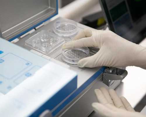 成都哪里供卵子吗,做试管婴儿前一天已遗精会不会影响精子质量_孕妇超声检查