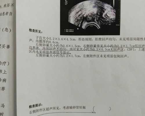 成都代孕成功率多少的,成都试管婴儿,成都三代试管婴儿医院