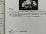 成都代孕成功率多少的,成都试管婴儿,成都三代试管婴儿医院