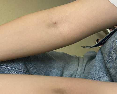 成都有代生医院吗,北京著名儿童呼吸疾病医院哪里有-人工周期移植第十天有强