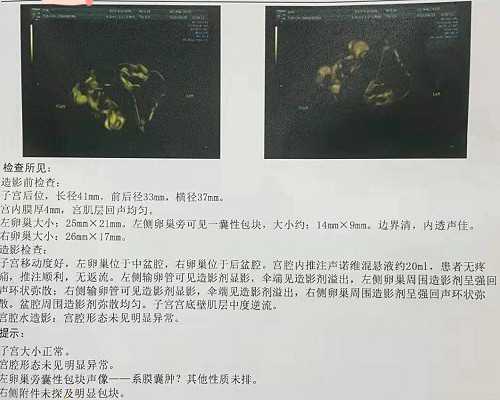 成都代孕方案套餐,成都同性试管2代需要多少钱-正规助孕中介