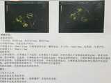 成都代孕方案套餐,成都同性试管2代需要多少钱-正规助孕中介