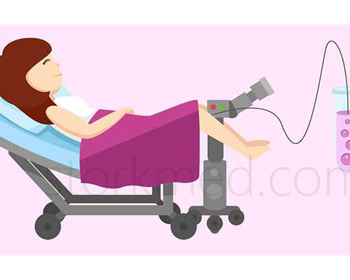 成都地下供卵,成都供卵机构