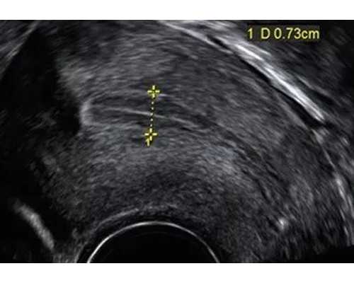 吃维E对备孕有什么好处？