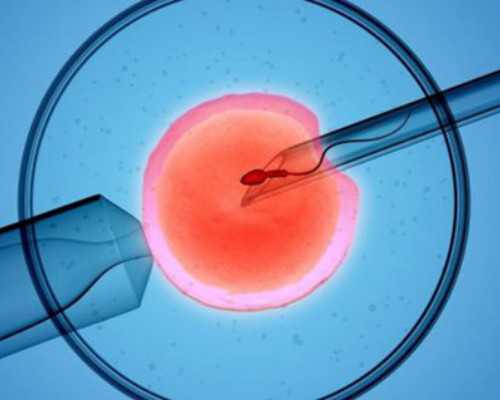 成都代孕指的是什么呀,成都试管婴儿技术,成都试管婴儿医院